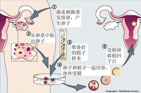 供卵代生网